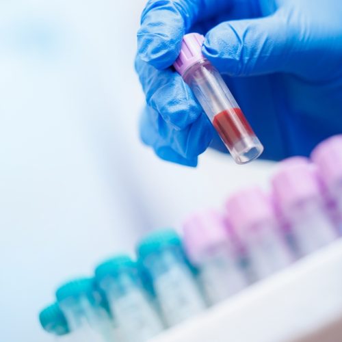 Gloved,Hands,Holding,Blood,Sample,At,Veterinary,Clinic,Laboratory.